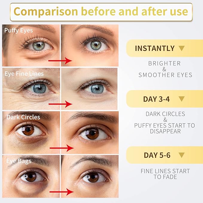 Under Eye Patches Gold Eye Mask